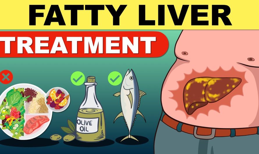 What are the natural treatments good for fatty liver?