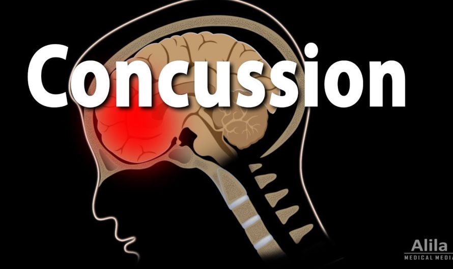 What are the Symptoms of Concussion?