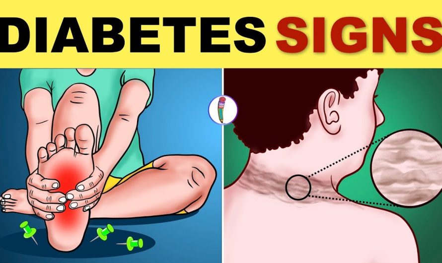 What are the Symptoms of Diabetes?