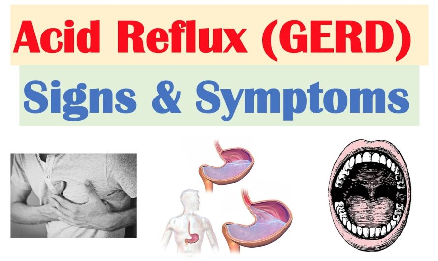 What are the Symptoms of Reflux? What Causes Reflux?