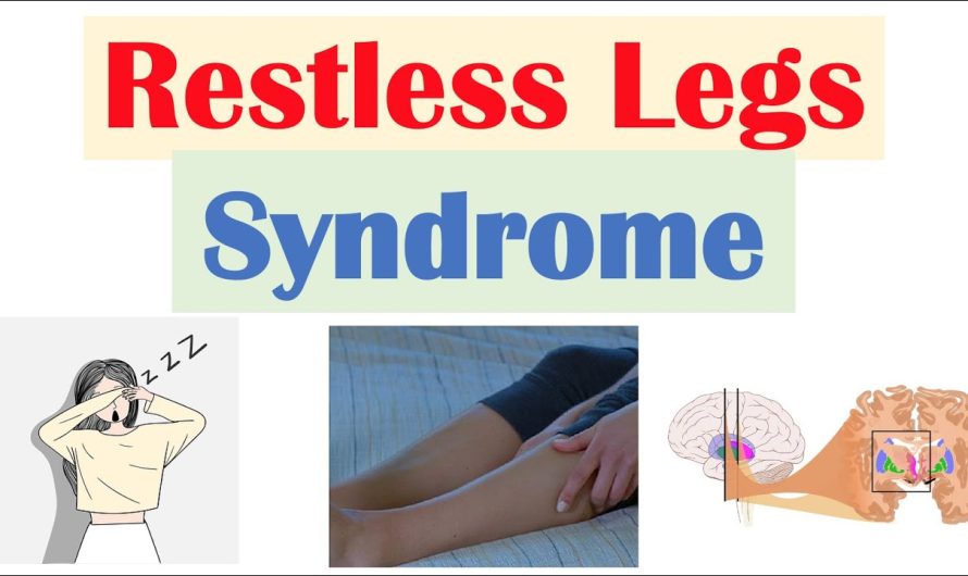 What are the Symptoms of Restless Leg Syndrome?