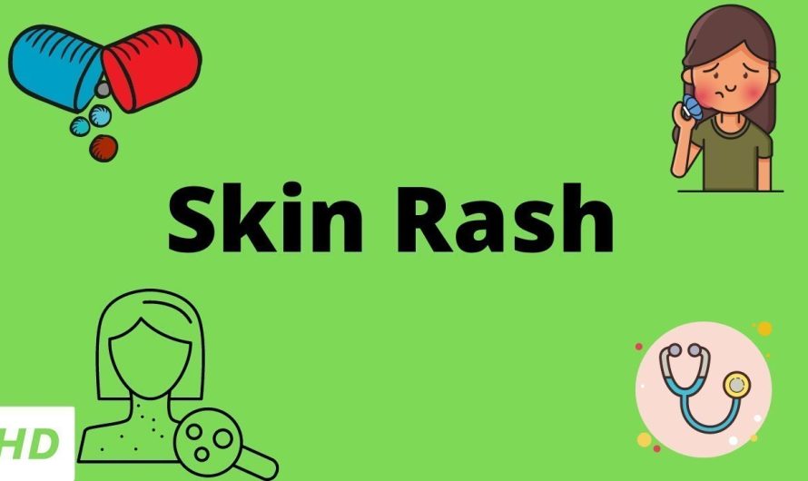 What Causes Skin Rash?