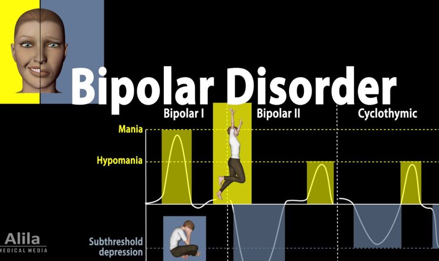 What is Bipolar Disorder, What are the Symptoms?