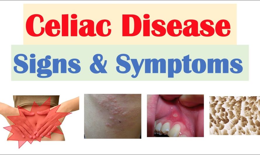 What is celiac disease, what are the symptoms of celiac disease?