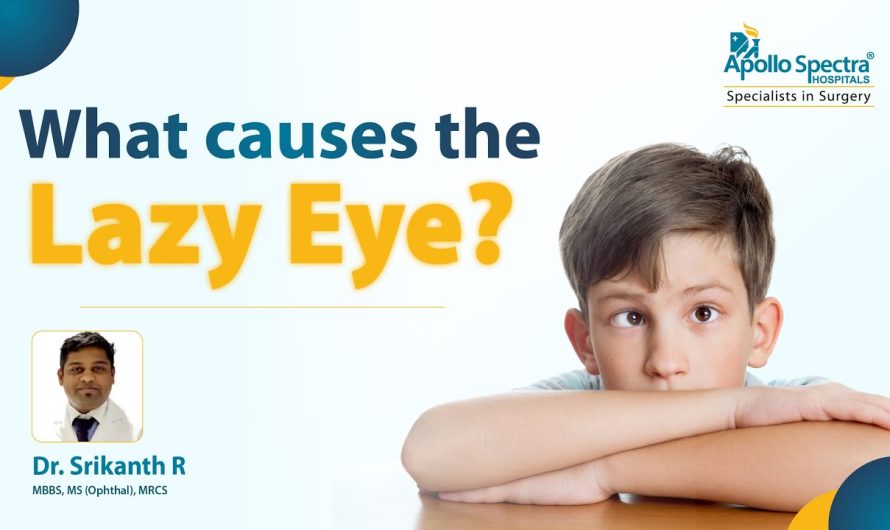 Why does lazy eye occur and how is it treated?
