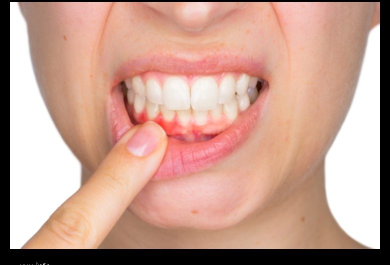 30 Ways to Keep Your Teeth Healthy